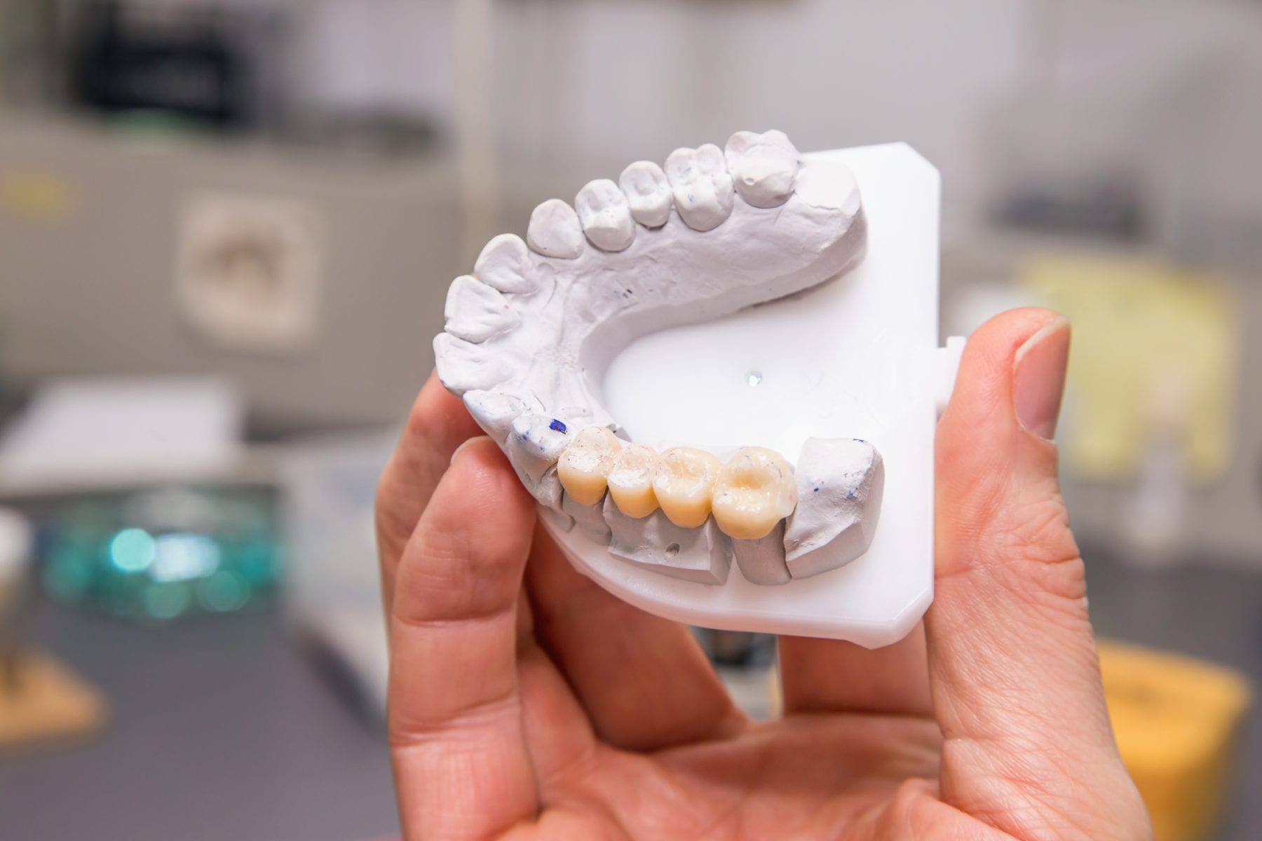 Restorative Dentistry Columbia MD Repair Or Replace Teeth restorative-dentistry-columbia-md-repair-or-replace-teeth