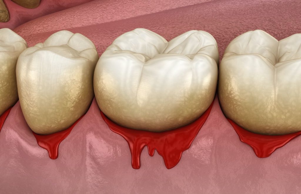 periodontal health Columbia Maryland