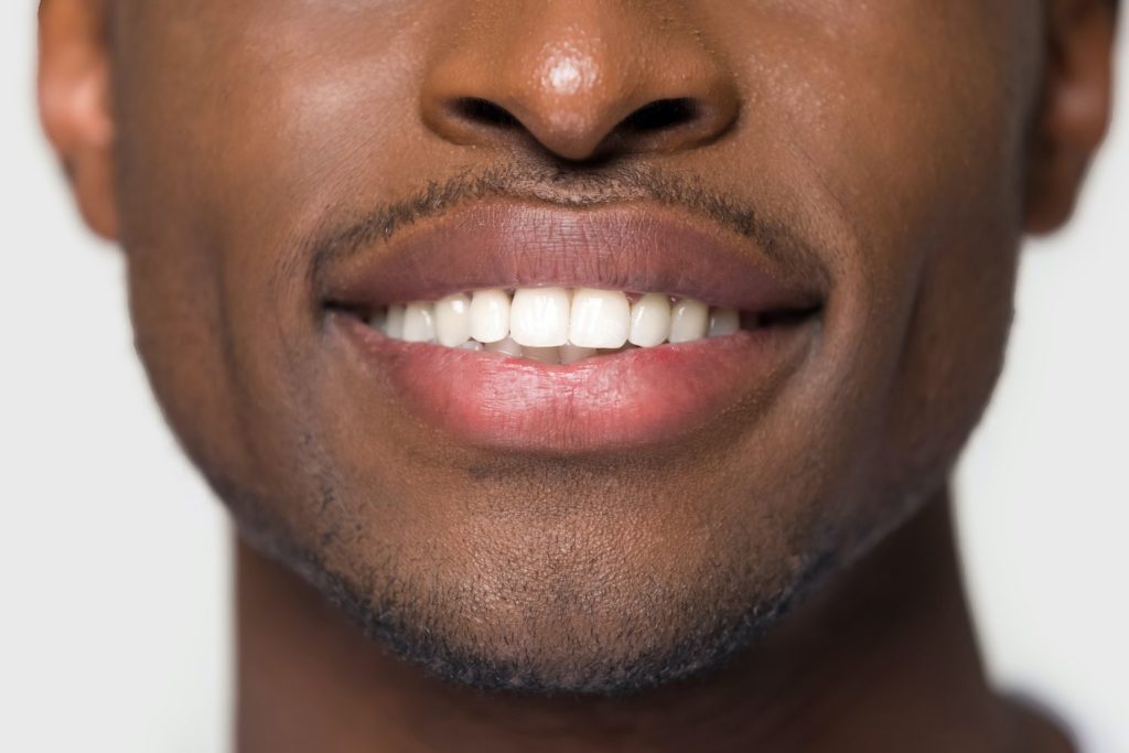 whiten your teeth Columbia Maryland